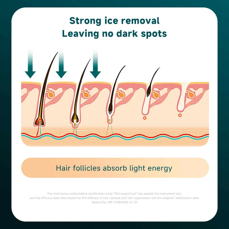 Strong Ice removal leaving no dark Ice Point Hair Remove