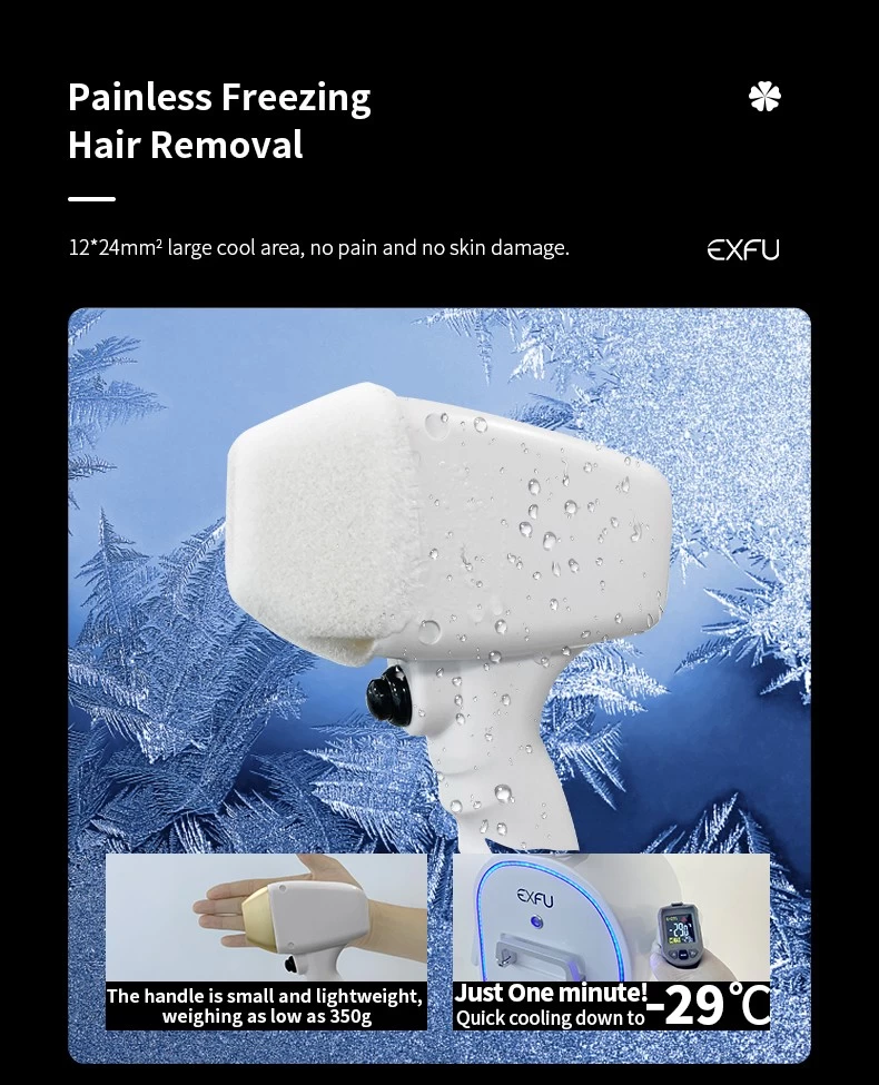 Exfu laser hair removal diode laser 808 755nm 808nm 1064nm hair removal 808 diode laser hair removal