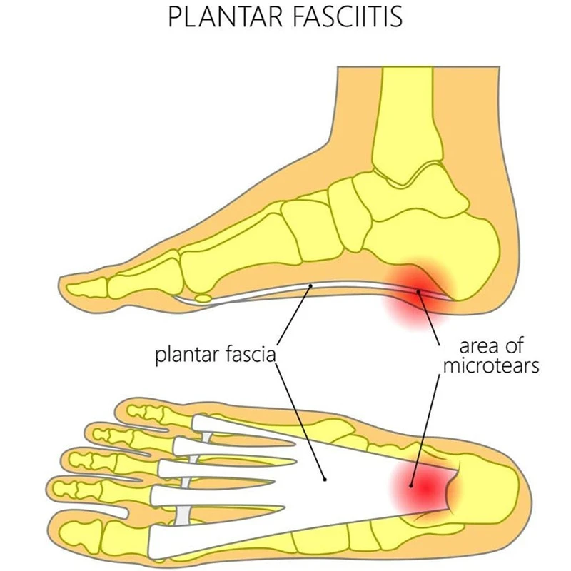 medical compression socks manufacturer