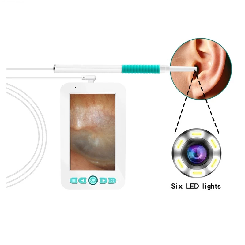otoscope vidéo, endoscope de cuillère pour nettoyage d'oreille
