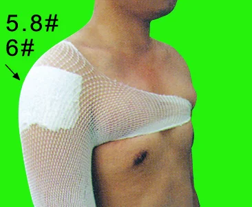 Elastische Bandage-medizinische rohrförmige Net-Verband mit hoher Elastizität