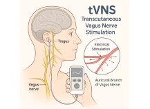 Nicht-invasive TVNS-Geräte für Angst, Schlaf und Wellness | Hersteller und OEM -Lieferant