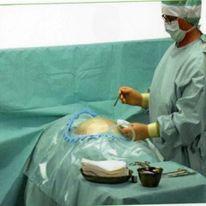 China Disposable Nonwoven Sterile C-Section Pack Set manufacturer
