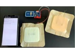 China Smart bandage measures wound healing through RFID manufacturer