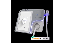 EXFU Tragbarer Diodenlaser 755 808 1064 Laser-Haarentfernung 808-nm-Diodenlaser-Haarentfernungsmaschine