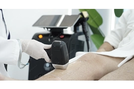 Warum Diodenlaser-Haarentfernung wählen? 2 Dinge, die Sie wissen müssen