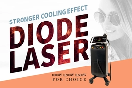 Welche Haarentfernung ist besser? IPL oder Diodenlaser