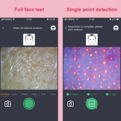 Ai System Wifi Connect Wireless Portable Beauty Face Skin Analysis Machine Use Phone Skin Analyzer