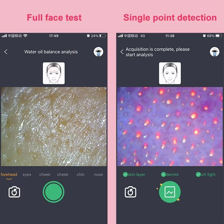 Handle Wifi Microscope Beauty Facial Analyzer Detector Equipment Wireless WIFI Tri Spectral AI Intelligent Skin Analyzer - COPY - 9i9nnw