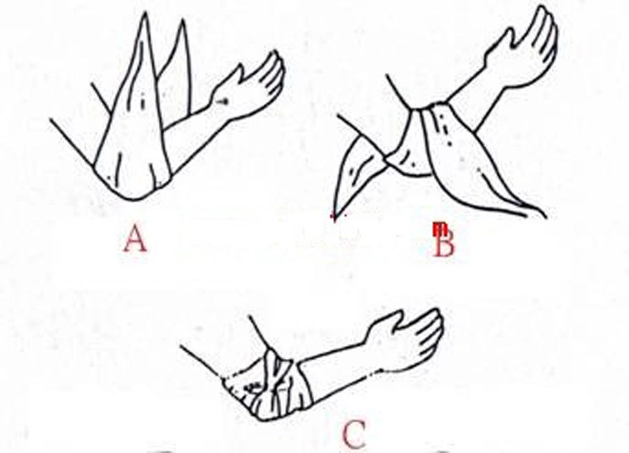 how to use Non-woven triangular bandage