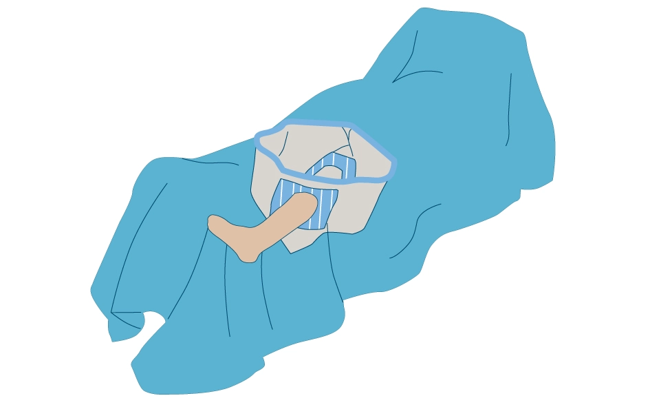 Knee Drape Pack, Knee set, Knee Drape,Arthroscopy Pack