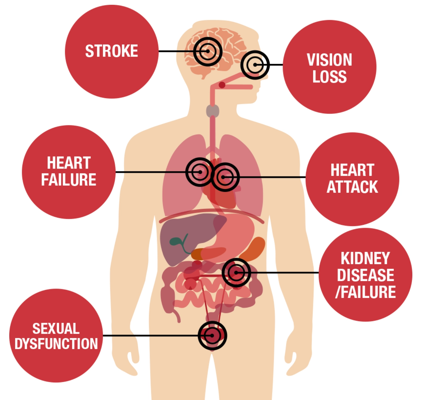 effects of high blood pressure,effects of hypertension,effects of bp,High blood pressure, hypertension, What are the effects of having high blood pressure