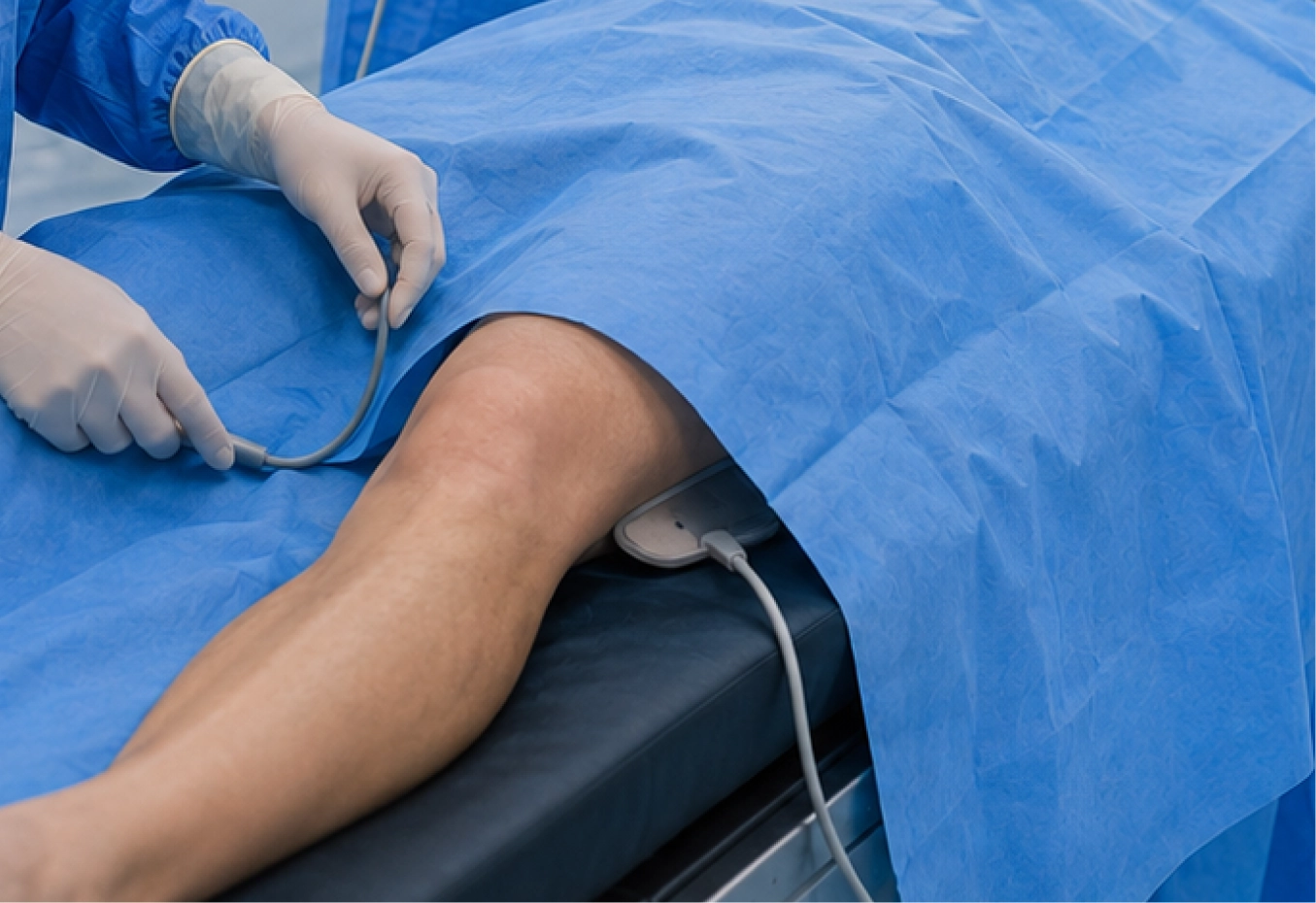 Die wiederverwendbare ESU-Patienten-Gegenelektrode wurde während der Einrichtung kompatibler elektrochirurgischer Geräte angeschlossen